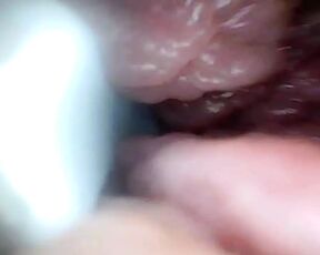 Endoscope Camera Shows the Most Sensitive Parts of the Penis Educational Video