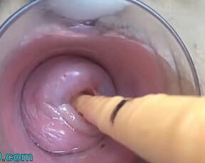 Porn uterus Cervix Tubes